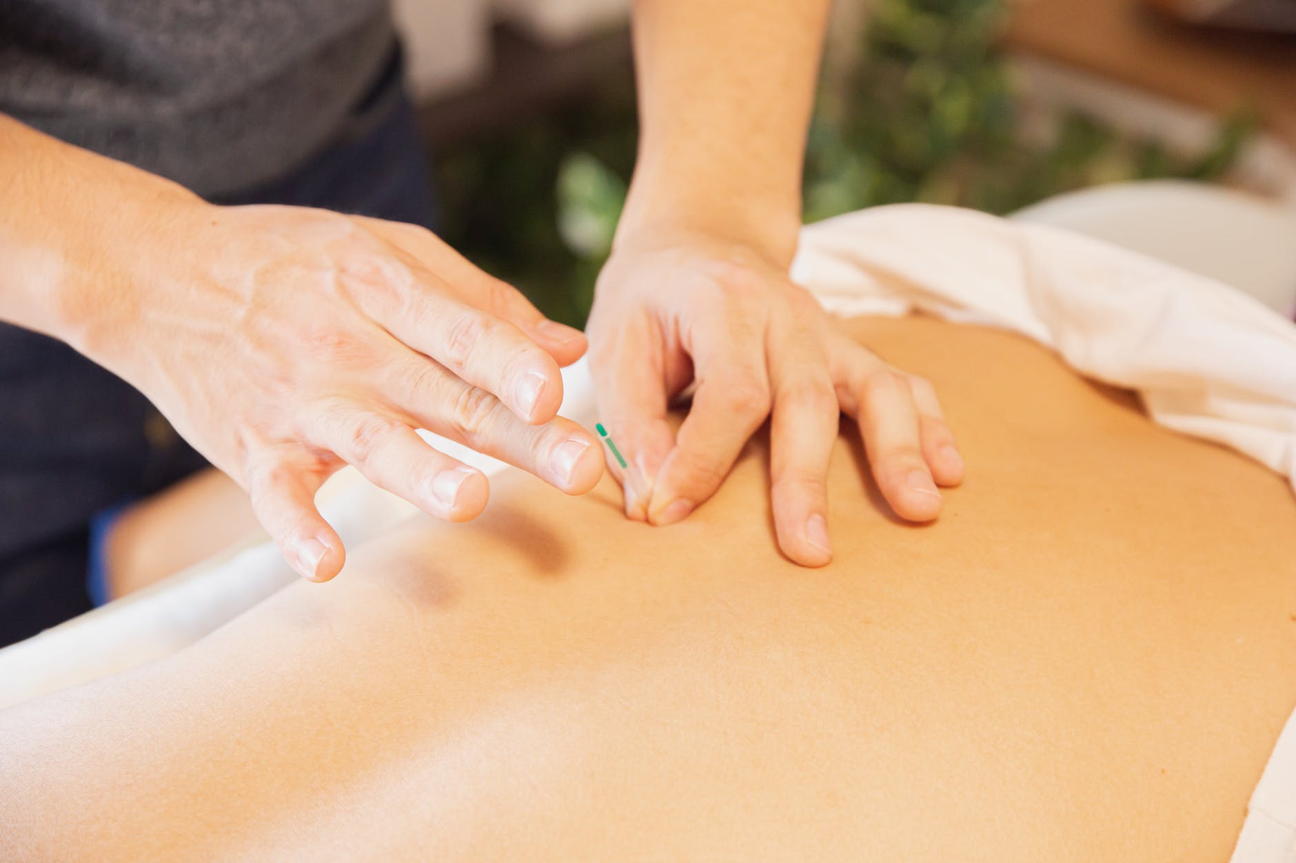 Does Acupuncture Work? We Debunk 5  Common Myths 